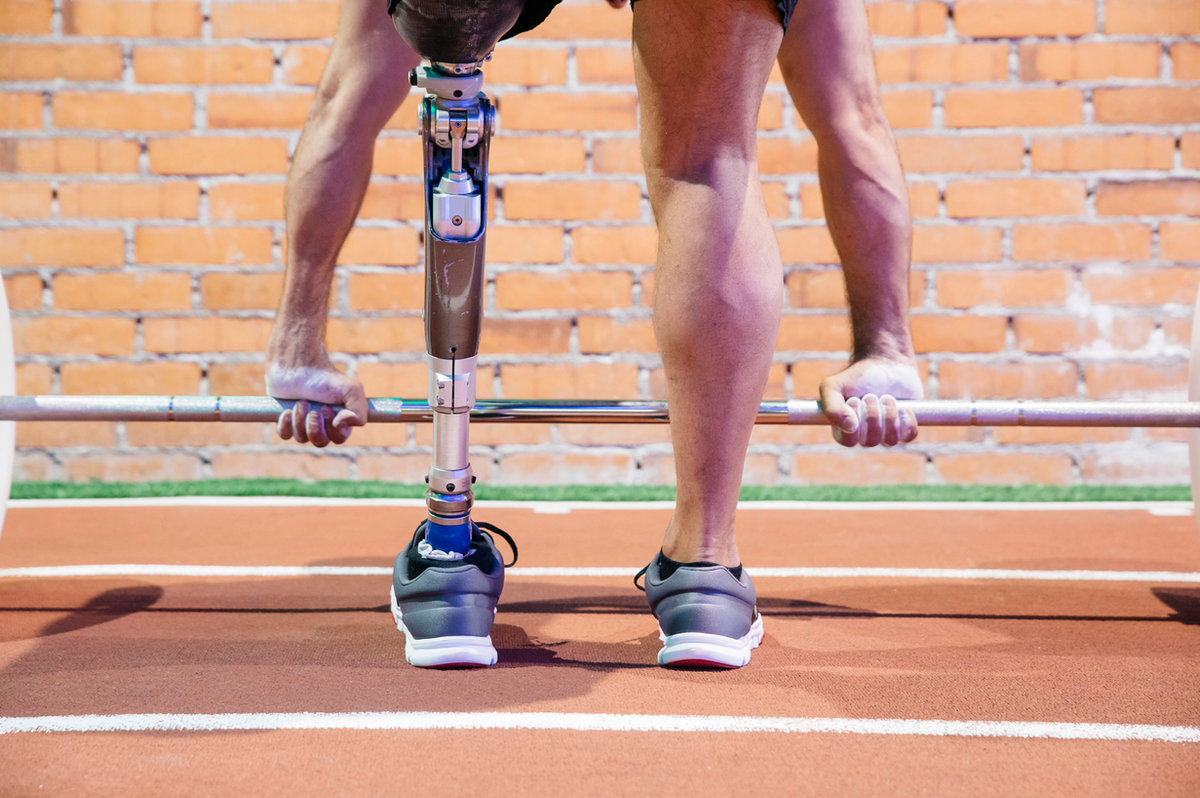 Permanent disability insurance NZ amputee